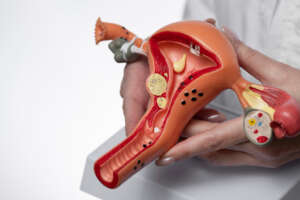Myomectomy: Procedure, Benefits, Risks & Recovery Guide