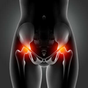Pelvic Pain Myths and Facts: Know When to Seek Medical Attention