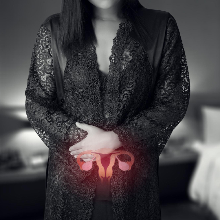 Untreated Uterine Fibroids: Causes, Symptoms & Treatments