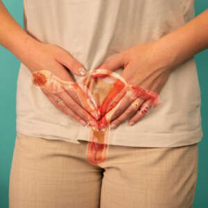 pcos-and-fertility-support