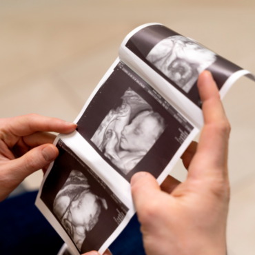 20 week anomaly scan ultrasound images showing baby development during pregnancy